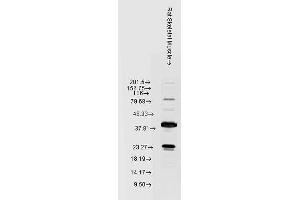 Western blot analysis of Rat Skeletal muscle lysates showing detection of HSP22 protein using Rabbit Anti-HSP22 Polyclonal Antibody (ABIN361851 and ABIN361852). (HSPB8 Antikörper)
