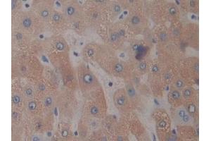 DAB staining on IHC-P; Samples: Human Liver Tissue (PTX3 Antikörper  (AA 183-381))
