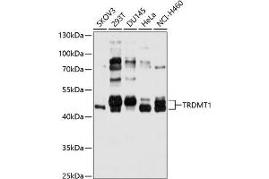 Western blot analysis of extracts of various cell lines, using TRDMT1 antibody (ABIN6131596, ABIN6149479, ABIN6149480 and ABIN6214817) at 1:1000 dilution. (Dnmt2 Antikörper  (AA 192-391))