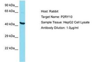 Image no. 1 for anti-Purinergic Receptor P2Y, G-Protein Coupled, 10 (P2RY10) (N-Term) antibody (ABIN6750599) (P2RY10 Antikörper  (N-Term))