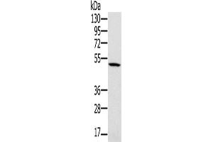 Western Blotting (WB) image for anti-Proteasome (Prosome, Macropain) 26S Subunit, ATPase, 2 (PSMC2) antibody (ABIN2423817) (PSMC2 Antikörper)