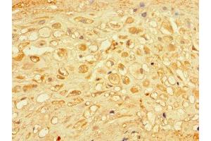 Immunohistochemistry of paraffin-embedded human placenta tissue using ABIN7166973 at dilution of 1:100 (CHM Antikörper  (AA 1-653))