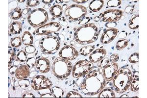 Immunohistochemical staining of paraffin-embedded Human Kidney tissue using anti-TBXAS1 mouse monoclonal antibody. (TBXAS1 Antikörper)