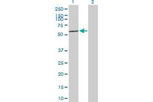 Western Blot analysis of TBX22 expression in transfected 293T cell line by TBX22 MaxPab polyclonal antibody.