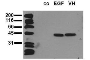 Western Blotting (WB) image for anti-Mitogen-Activated Protein Kinase 3 (MAPK3) (pThr-Glu-pTyr) antibody (ABIN126831) (ERK1 Antikörper  (pThr-Glu-pTyr))