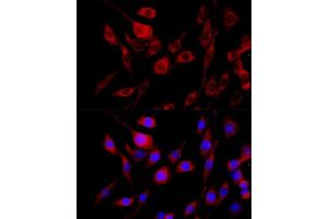Immunofluorescence analysis of PC-12 cells using FGFR2 antibody (ABIN6130457, ABIN6140615, ABIN6140617 and ABIN6216059) at dilution of 1:100 (40x lens). (FGFR2 Antikörper  (AA 245-345))