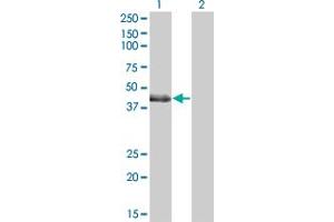 Western Blot analysis of LMCD1 expression in transfected 293T cell line by LMCD1 polyclonal antibody (A01).
