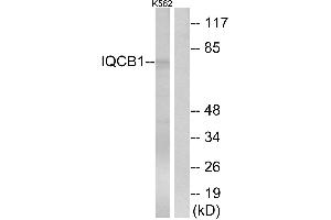 Western blot analysis of extracts from K562 cells, using IQCB1 antibody. (IQCB1 Antikörper)