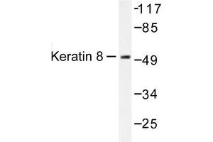 Image no. 1 for anti-Keratin 8 (KRT8) antibody (ABIN265504) (KRT8 Antikörper)