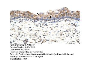 Rabbit Anti-GNB1L Antibody  Paraffin Embedded Tissue: Human Skin Cellular Data: Squamous epithelial cells Antibody Concentration: 4. (GNB1L Antikörper  (C-Term))