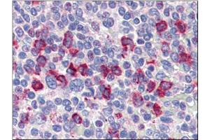 Human Spleen (formalin-fixed, paraffin-embedded) stained with CD14at 4 µg/ml followed by biotinylated anti-goat IgG secondary antibody, alkaline phosphatase-streptavidin and chromogen. (CD14 Antikörper)