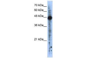 RBMS2 antibody used at 1 ug/ml to detect target protein.