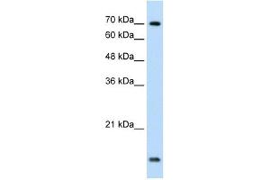 UBE2L3 antibody used at 1. (UBE2L3 Antikörper  (C-Term))