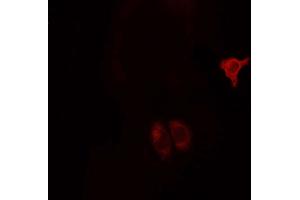 ABIN6268685 staining MCF7 cells by ICC/IF. (CD9 Antikörper  (Internal Region))