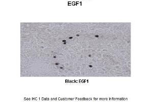 Sample Type :  Frog brain  Primary Antibody Dilution :  1:500  Secondary Antibody :  Biotinylated goat anti-rabbit  Secondary Antibody Dilution :  1:200  Color/Signal Descriptions :  Black: EGF1  Gene Name :  EGR1 a  Submitted by :  Eva Fischer, Colorado State University (EGR1 Antikörper  (N-Term))