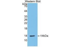 Western blot analysis of recombinant Rat REN. (Renin Antikörper  (AA 275-389))
