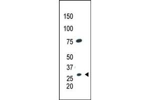 Western Blotting (WB) image for anti-Caudal Type Homeobox 1 (CDX1) (AA 236-265), (C-Term) antibody (ABIN390075)
