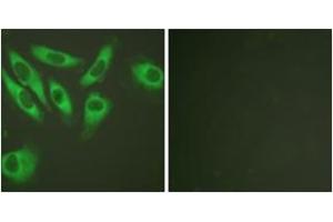 Immunofluorescence analysis of HeLa cells, using S6 Ribosomal Protein (Ab-240) Antibody. (RPS6 Antikörper  (AA 191-240))
