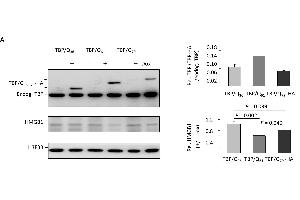 HMGB1 dysfunction in TBP/Q61~79 SH-SY5Y cells and the associated neuronal phenotype. (Histone H3.3B Antikörper  (full length))