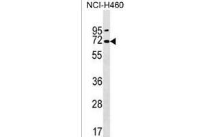 PKD2L2 Antibody (Center) (ABIN1538023 and ABIN2850127) western blot analysis in NCI- cell line lysates (35 μg/lane). (PKD2L2 Antikörper  (AA 193-219))