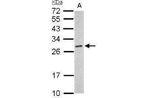 WB Image Proteasome 20S alpha 6 antibody detects PSMA6 protein by Western blot analysis.