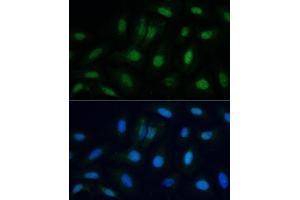 Immunofluorescence analysis of U-2 OS cells using ETS2 antibody (ABIN6133259, ABIN6140325, ABIN6140326 and ABIN6223170) at dilution of 1:100. (ETS2 Antikörper  (AA 160-350))