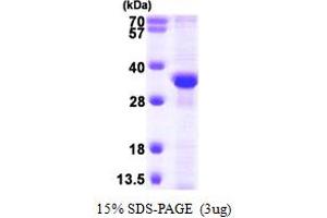 SDS-PAGE (SDS) image for Replication Protein A2, 32kDa (RPA2) (AA 1-270) protein (His tag) (ABIN7279229) (RPA2 Protein (AA 1-270) (His tag))