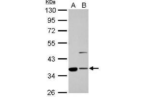 WB Image Annexin II antibody [N1], N-term detects ANXA2 protein by Western blot analysis.