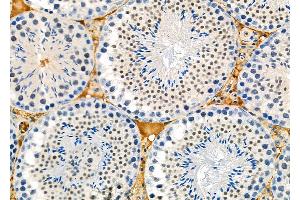 ABIN6261407 and ABIN6273114 at 1/100 staining Mouse testis tissue by IHC-P. (DYX1C1 Antikörper)