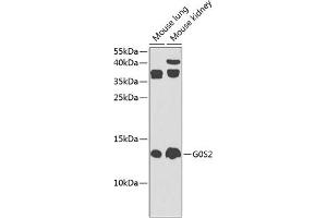Western blot analysis of extracts of various cell lines, using G0S2 Antibody (ABIN6134775, ABIN6140856, ABIN6140858 and ABIN6225312) at 1:1000 dilution. (G0S2 Antikörper  (AA 1-100))