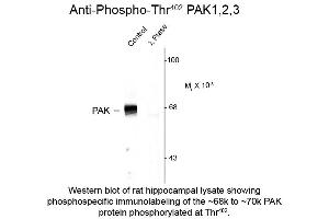 Western blot of Anti-PAK 1/2/3 pT402 (Rabbit) Antibody - 612-401-E05 Western Blot of Rabbit anti-PAK 1/2/3 pT402 antibody. (PAK1/2/3 Antikörper  (pThr402))