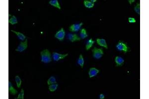 Immunofluorescence staining of Hela cells with ABIN7159440 at 1:50, counter-stained with DAPI. (Metabotropic Glutamate Receptor 3 Antikörper  (AA 46-354))