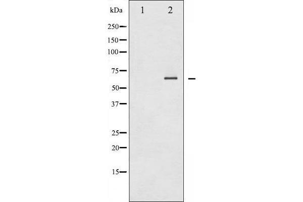 SYK antibody  (pTyr348)