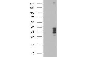 Western Blotting (WB) image for anti-Homeobox C11 (HOXC11) (AA 1-304) antibody (ABIN1490735) (HOXC11 Antikörper  (AA 1-304))