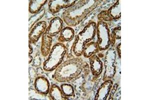 Immunohistochemistry analysis in formalin fixed and paraffin embedded human kidney tissue reacted with NDUFC2 Antibody (C-term) followed which was peroxidase conjugated to the secondary antibody and followed by DAB staining. (NDUFC2 Antikörper  (C-Term))