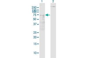 Western Blot analysis of ALOX5 expression in transfected 293T cell line ( H00000240-T01 ) by ALOX5 MaxPab polyclonal antibody. (ALOX5 Antikörper  (AA 1-674))