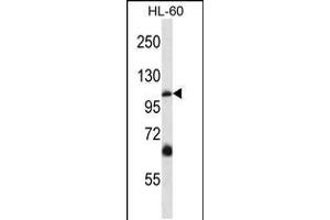 Western blot analysis in HL-60 cell line lysates (35ug/lane). (TRPC5 Antikörper  (N-Term))
