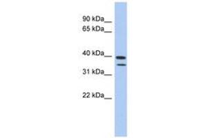 Image no. 1 for anti-Methyltransferase Like 19 (METTL19) (AA 427-476) antibody (ABIN6743698) (C4ORF23 Antikörper  (AA 427-476))