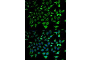Immunofluorescence analysis of HeLa cells using SLC25A20 antibody (ABIN5974144).