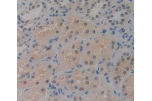 IHC-P analysis of kidney tissue, with DAB staining. (CDK2AP1 Antikörper  (AA 1-115))
