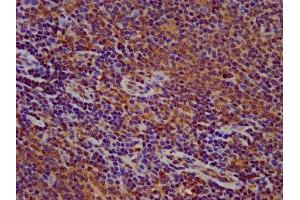 IHC image of ABIN7165598 diluted at 1:500 and staining in paraffin-embedded human lymph node tissue performed on a Leica BondTM system. (FLII Antikörper  (AA 577-729))