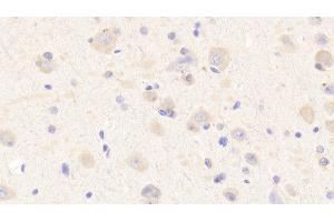 Detection of MXRA5 in Human Cerebrum Tissue using Polyclonal Antibody to Matrix Remodelling Associated Protein 5 (MXRA5) (Matrix Remodelling Associated Protein 5 (AA 2542-2828) Antikörper)