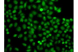 Immunofluorescence analysis of A549 cells using PIP5K1A antibody (ABIN6292233). (PIP5K1A Antikörper)