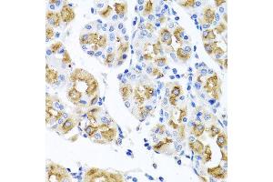 Immunohistochemistry of paraffin-embedded human gastric using FECH antibody at dilution of 1:100 (x40 lens). (FECH Antikörper)