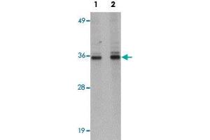 Western blot analysis of HepG2 cells with RSRC1 polyclonal antibody  at (Lane 1) 1 and (Lane 2) 2 ug/mL dilution. (RSRC1 Antikörper  (C-Term))