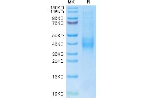 Biotinylated Human NKG2C on Tris-Bis PAGE under reduced condition. (KLRC2 Protein (AA 98-231) (His-Avi Tag,Biotin))