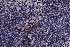 ABIN6267639 at 1/200 staining human lymph node tissue sections by IHC-P.