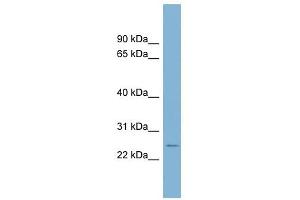 CD160 antibody used at 1 ug/ml to detect target protein. (CD160 Antikörper  (Middle Region))