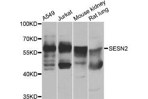 Western blot analysis of extracts of various cell lines, using SESN2 antibody (ABIN4905132) at 1:1000 dilution. (Sestrin 2 Antikörper)