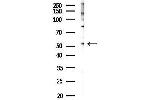 Western blot analysis of lysates from PC12 cells(LPS 4h treatment), using CDC25C Antibody at 1/1000 dilution.